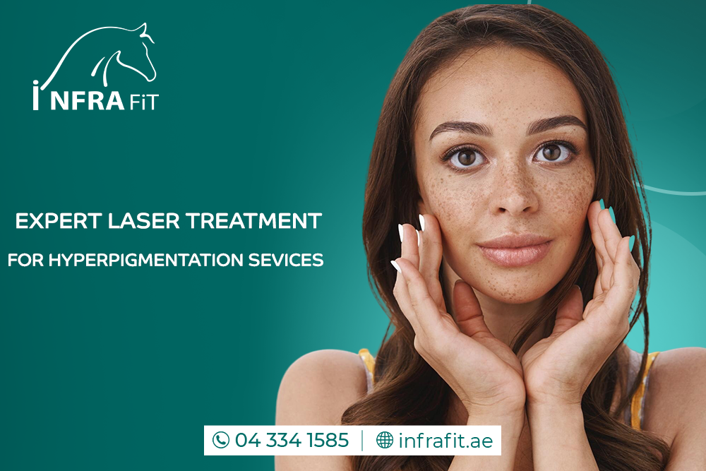 Laser treatment for hyperpigmentation