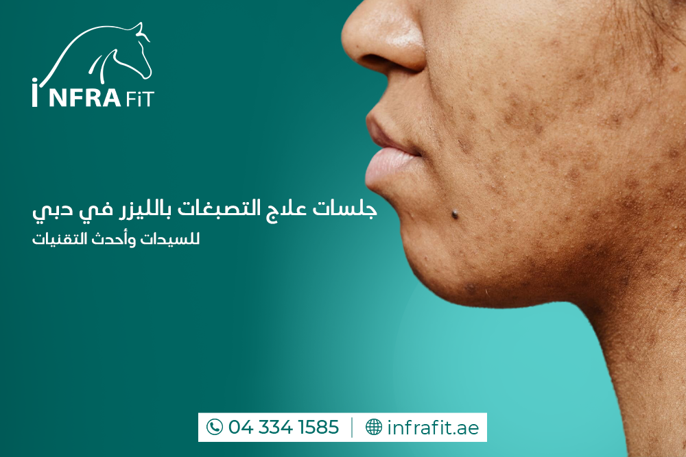علاج التصبغات بالليزر في دبي للسيدات