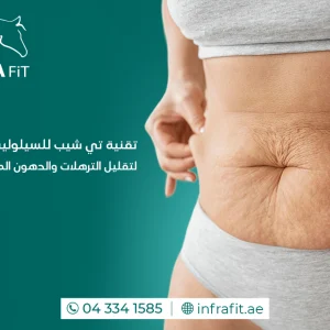 تقنية تي شيب للسيلوليت