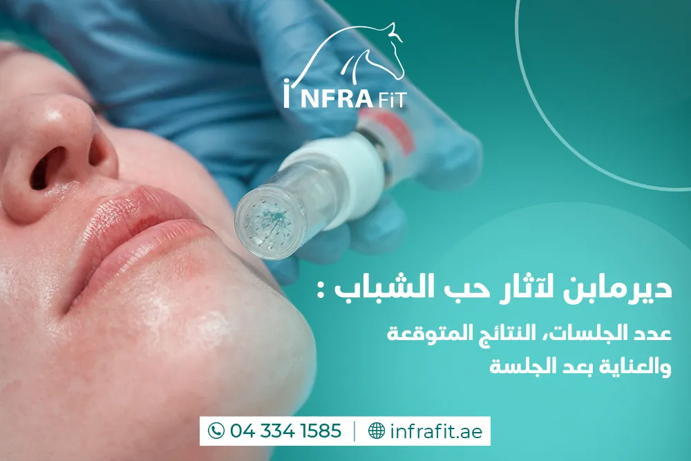 ديرمابن لاثار حب الشباب