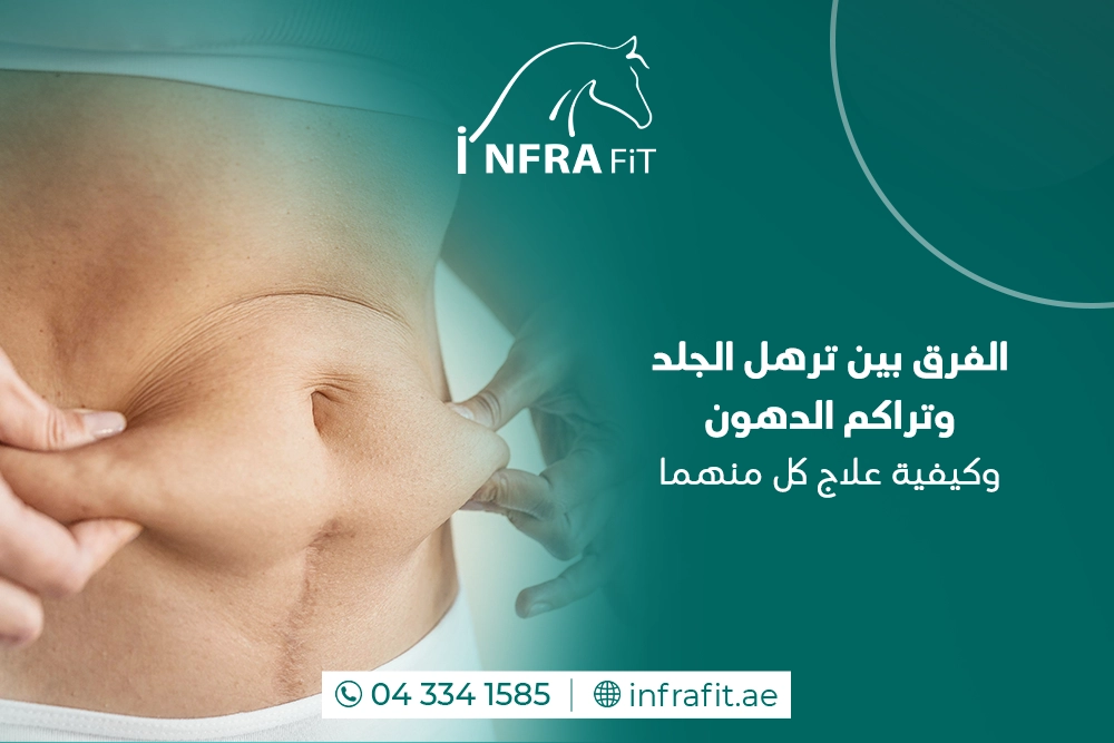 ترهل الجلد وتراكم الدهون